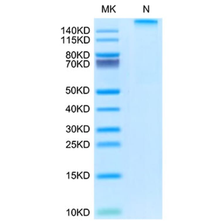 Tris-Bis PAGE - Recombinant Rhesus macaque HLA-G Protein (C-terminal His and Avi Tag) (A330741) - Antibodies.com