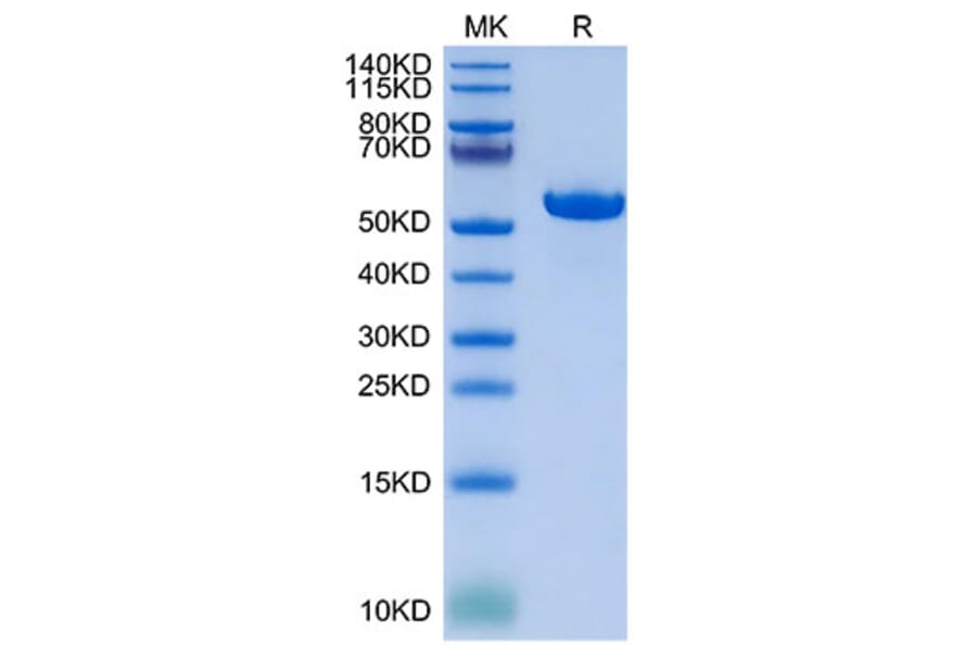 Tris-Bis PAGE - Recombinant Human HLA-G Protein (C-terminal His and Avi Tag) (A330742) - Antibodies.com