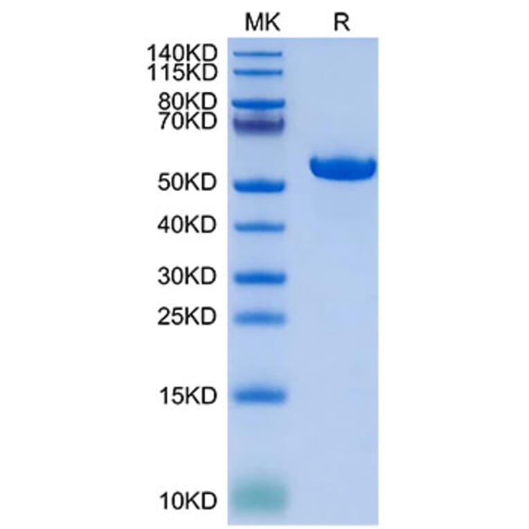 Tris-Bis PAGE - Recombinant Human HLA-G Protein (C-terminal His and Avi Tag) (A330742) - Antibodies.com