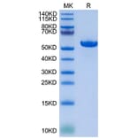 Tris-Bis PAGE - Recombinant Human HLA-G Protein (C-terminal His and Avi Tag) (A330742) - Antibodies.com