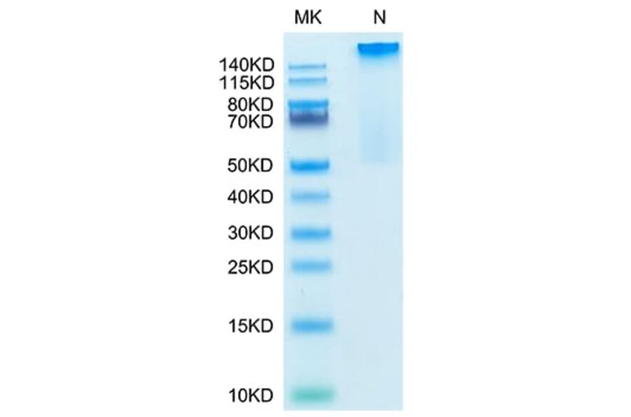 Tris-Bis PAGE - Recombinant Human HLA-G Protein (C-terminal His and Avi Tag) (A330743) - Antibodies.com