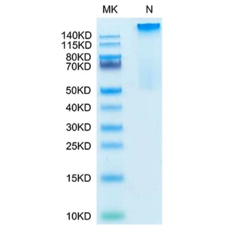 Tris-Bis PAGE - Recombinant Human HLA-G Protein (C-terminal His and Avi Tag) (A330743) - Antibodies.com