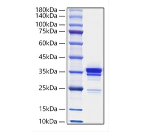 SDS-PAGE - Recombinant Mouse HMGB1 Protein (C-terminal His Tag) (A330744) - Antibodies.com