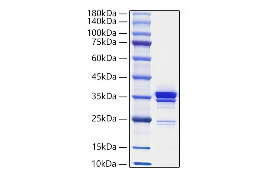 SDS-PAGE - Recombinant Mouse HMGB1 Protein (C-terminal His Tag) (A330744) - Antibodies.com