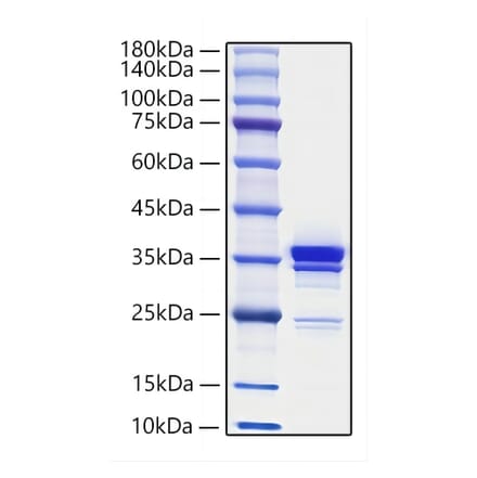 SDS-PAGE - Recombinant Mouse HMGB1 Protein (C-terminal His Tag) (A330744) - Antibodies.com