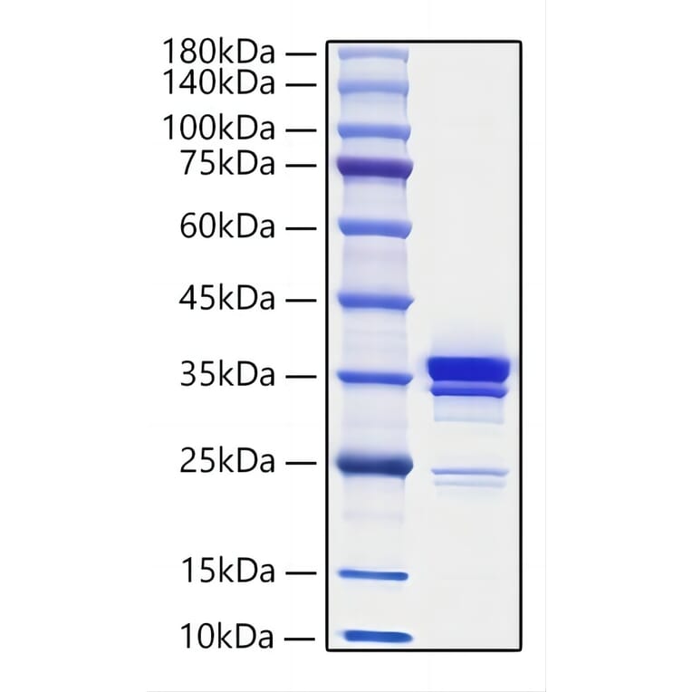 SDS-PAGE - Recombinant Mouse HMGB1 Protein (C-terminal His Tag) (A330744) - Antibodies.com