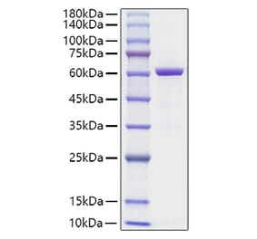 SDS-PAGE - Recombinant Human HMGB1 Protein (C-terminal His Tag) (A330746) - Antibodies.com