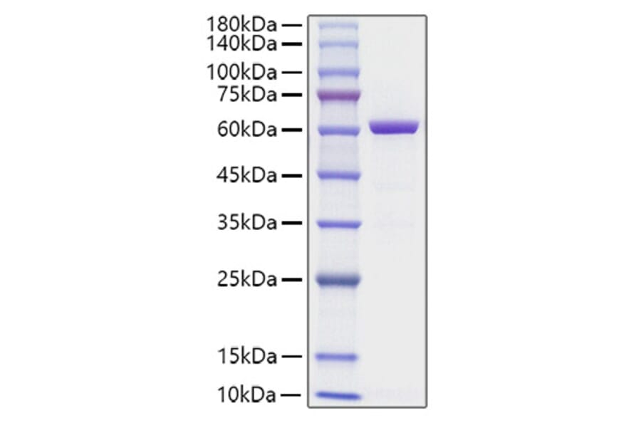 SDS-PAGE - Recombinant Human HMGB1 Protein (C-terminal His Tag) (A330746) - Antibodies.com