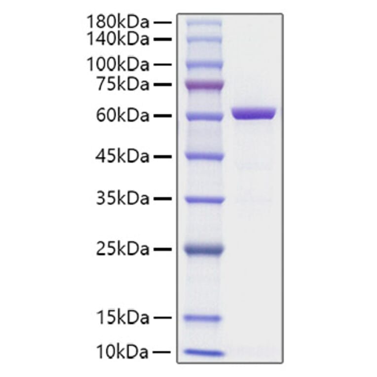SDS-PAGE - Recombinant Human HMGB1 Protein (C-terminal His Tag) (A330746) - Antibodies.com