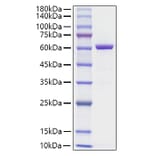 SDS-PAGE - Recombinant Human HMGB1 Protein (C-terminal His Tag) (A330746) - Antibodies.com