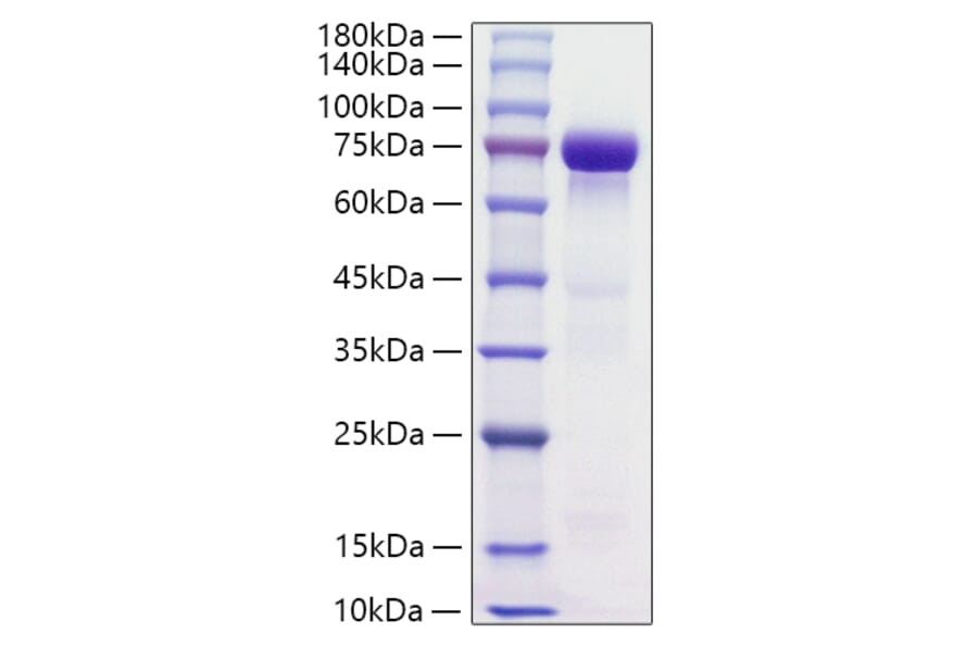 SDS-PAGE - Recombinant Human HRG Protein (C-terminal His Tag) (A330749) - Antibodies.com