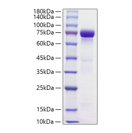 SDS-PAGE - Recombinant Human HRG Protein (C-terminal His Tag) (A330749) - Antibodies.com
