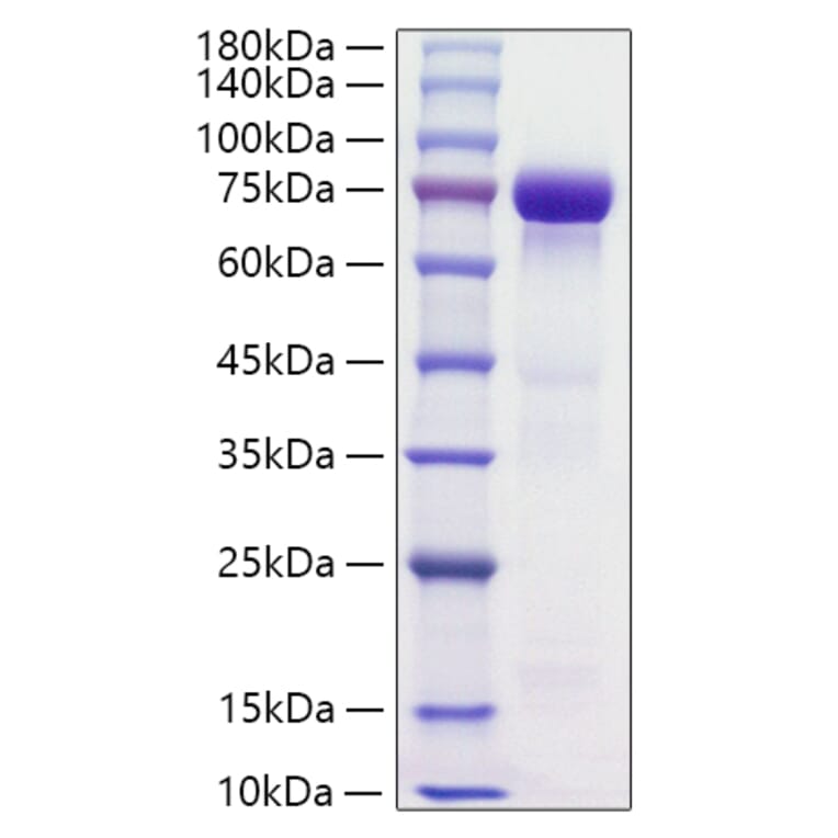 SDS-PAGE - Recombinant Human HRG Protein (C-terminal His Tag) (A330749) - Antibodies.com