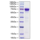 SDS-PAGE - Recombinant Human HRG Protein (C-terminal His Tag) (A330749) - Antibodies.com