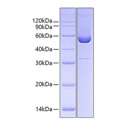 SDS-PAGE - Recombinant Human HSP47 Protein (C-terminal His Tag) (A330751) - Antibodies.com