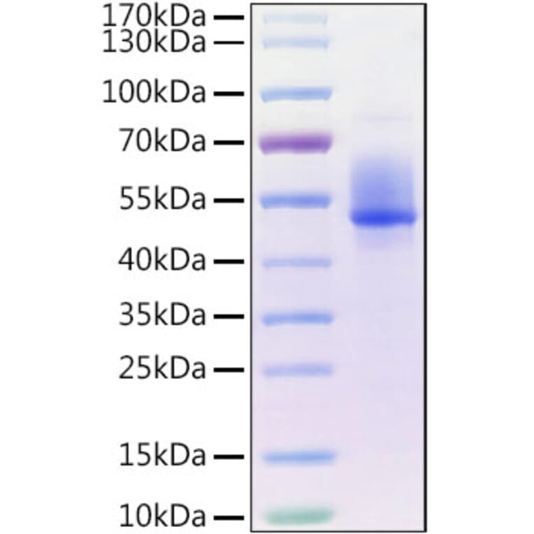 SDS-PAGE - Recombinant Human HSP60 Protein (N-terminal GST and His Tag) (A330752) - Antibodies.com