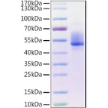 SDS-PAGE - Recombinant Human HSP60 Protein (N-terminal GST and His Tag) (A330752) - Antibodies.com