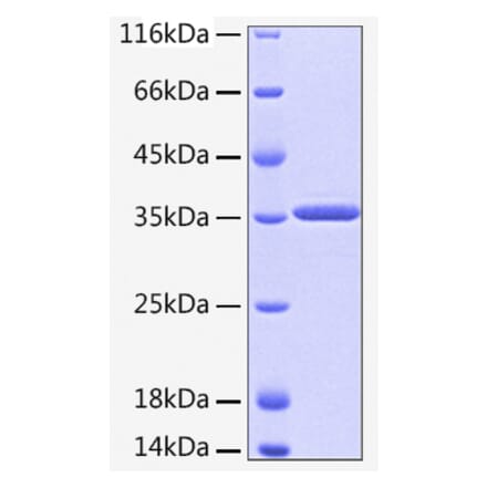 SDS-PAGE - Recombinant Human HTRA2 Protein (A330753) - Antibodies.com