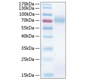 SDS-PAGE - Recombinant Human ICAM1 Protein (C-terminal His Tag) (A330754) - Antibodies.com