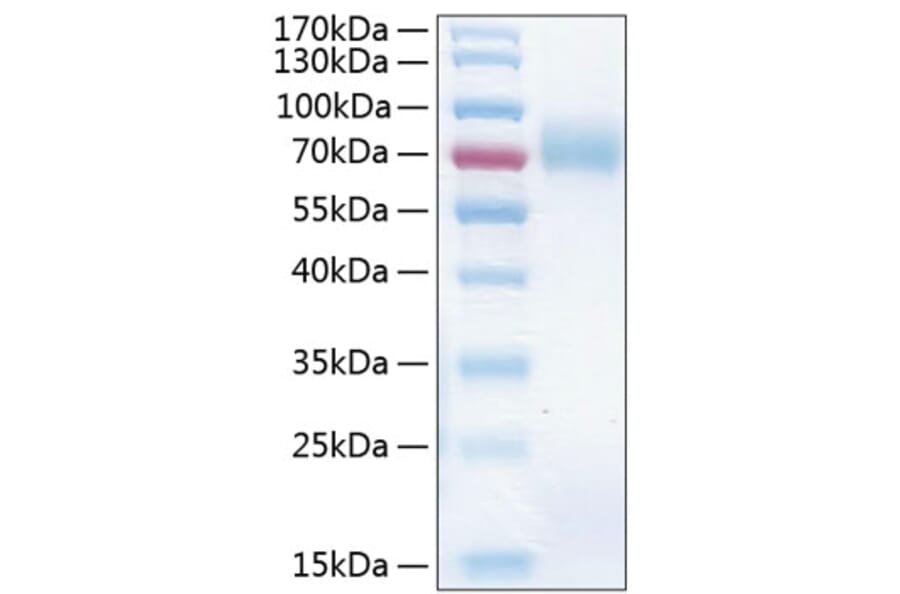 SDS-PAGE - Recombinant Human ICAM1 Protein (C-terminal His Tag) (A330754) - Antibodies.com