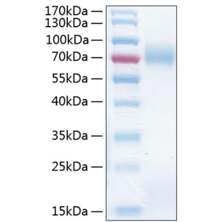 SDS-PAGE - Recombinant Human ICAM1 Protein (C-terminal His Tag) (A330754) - Antibodies.com