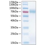 SDS-PAGE - Recombinant Human ICAM1 Protein (C-terminal His Tag) (A330754) - Antibodies.com