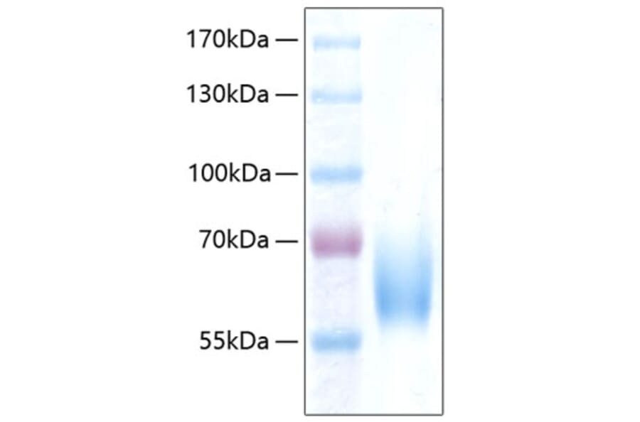 SDS-PAGE - Recombinant Human ICAM2 Protein (C-terminal Human Fc and His Tag) (A330755) - Antibodies.com