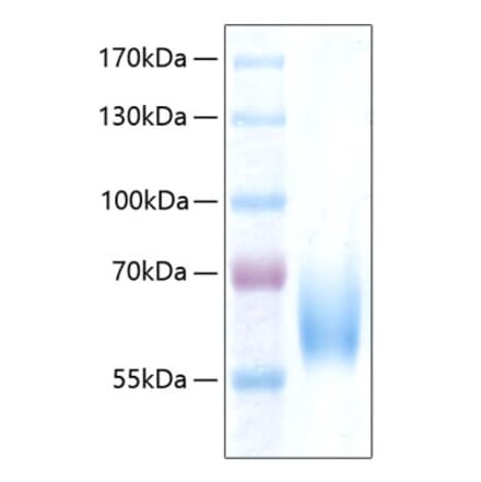 SDS-PAGE - Recombinant Human ICAM2 Protein (C-terminal Human Fc and His Tag) (A330755) - Antibodies.com