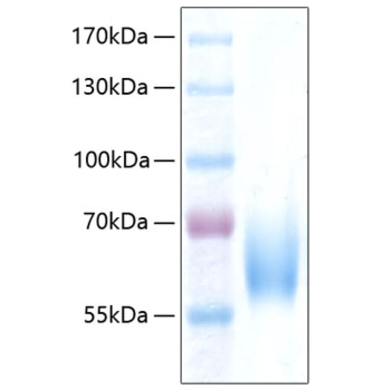 SDS-PAGE - Recombinant Human ICAM2 Protein (C-terminal Human Fc and His Tag) (A330755) - Antibodies.com