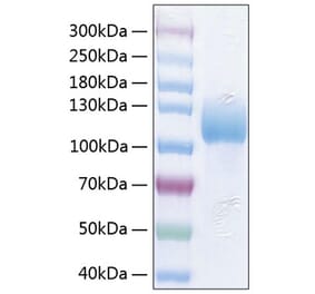 SDS-PAGE - Recombinant Human ICAM3 Protein (C-terminal Human Fc and His Tag) (A330756) - Antibodies.com