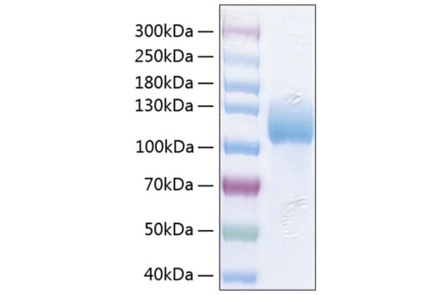 SDS-PAGE - Recombinant Human ICAM3 Protein (C-terminal Human Fc and His Tag) (A330756) - Antibodies.com