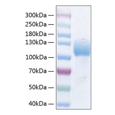 SDS-PAGE - Recombinant Human ICAM3 Protein (C-terminal Human Fc and His Tag) (A330756) - Antibodies.com