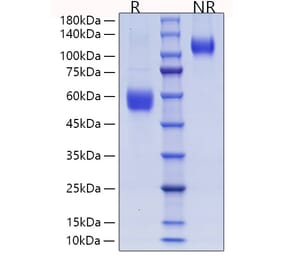 SDS-PAGE - Recombinant Human ICOS Protein (C-terminal Human Fc and His Tag) (A330757) - Antibodies.com