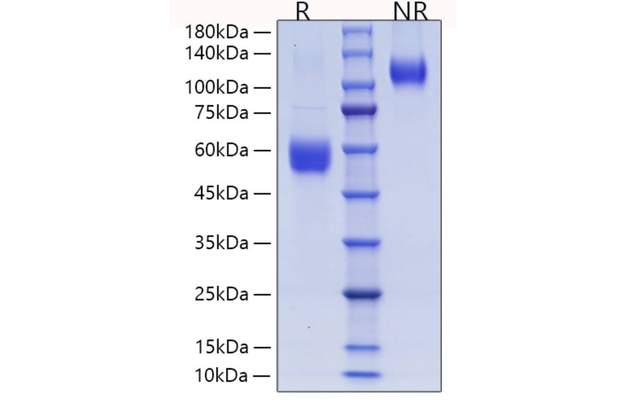 SDS-PAGE - Recombinant Human ICOS Protein (C-terminal Human Fc and His Tag) (A330757) - Antibodies.com