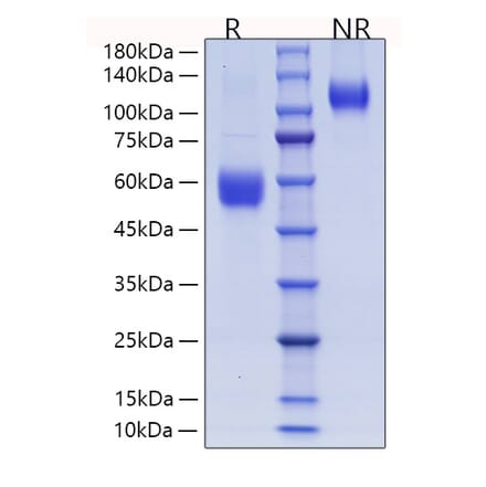 SDS-PAGE - Recombinant Human ICOS Protein (C-terminal Human Fc and His Tag) (A330757) - Antibodies.com
