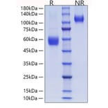 SDS-PAGE - Recombinant Human ICOS Protein (C-terminal Human Fc and His Tag) (A330757) - Antibodies.com