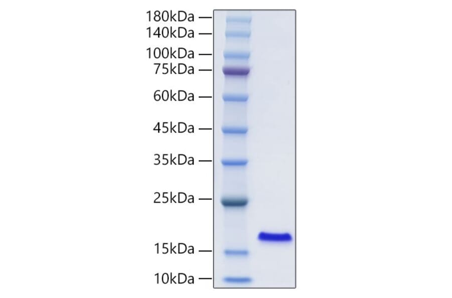 SDS-PAGE - Recombinant Human I-FABP Protein (N-terminal His Tag) (A330759) - Antibodies.com