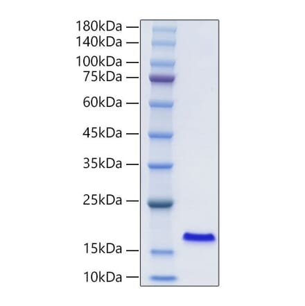 SDS-PAGE - Recombinant Human I-FABP Protein (N-terminal His Tag) (A330759) - Antibodies.com