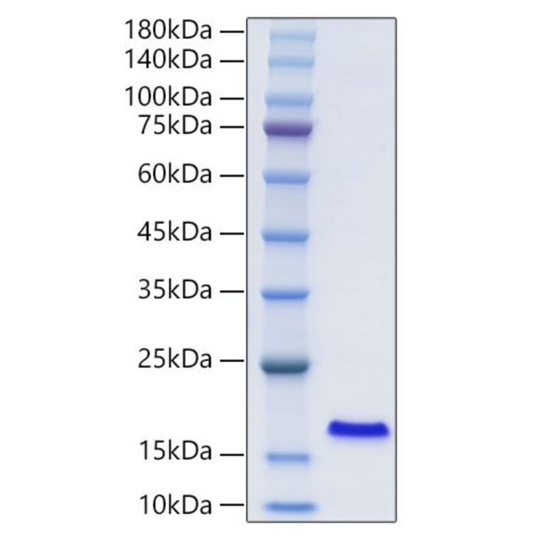SDS-PAGE - Recombinant Human I-FABP Protein (N-terminal His Tag) (A330759) - Antibodies.com