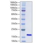 SDS-PAGE - Recombinant Human I-FABP Protein (N-terminal His Tag) (A330759) - Antibodies.com