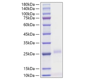 SDS-PAGE - Recombinant Human IFN beta Protein (C-terminal His Tag) (A330760) - Antibodies.com