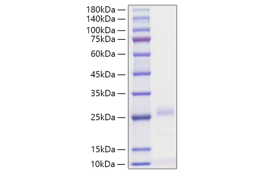 SDS-PAGE - Recombinant Human IFN beta Protein (C-terminal His Tag) (A330760) - Antibodies.com