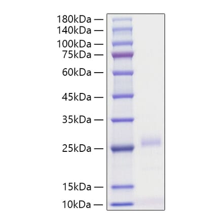 SDS-PAGE - Recombinant Human IFN beta Protein (C-terminal His Tag) (A330760) - Antibodies.com