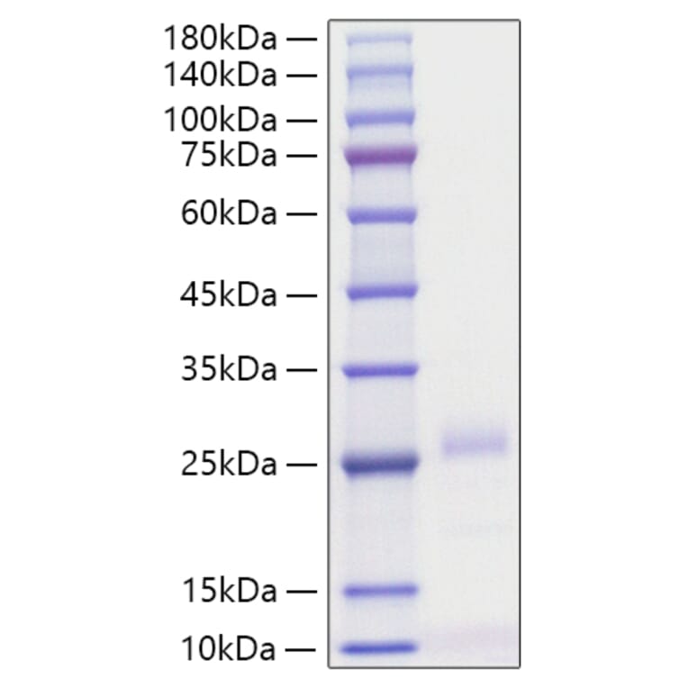 SDS-PAGE - Recombinant Human IFN beta Protein (C-terminal His Tag) (A330760) - Antibodies.com