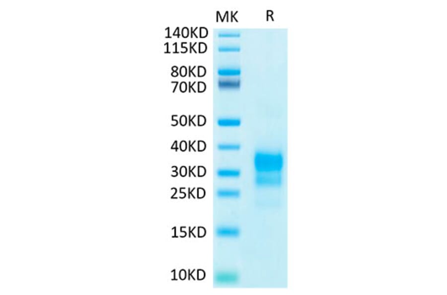 Tris-Bis PAGE - Recombinant Human IFN gamma Protein (Biotin) (C-terminal His and Avi Tag) (A330761) - Antibodies.com