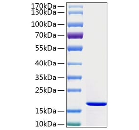 SDS-PAGE - Recombinant Human IFN gamma Protein (A330762) - Antibodies.com