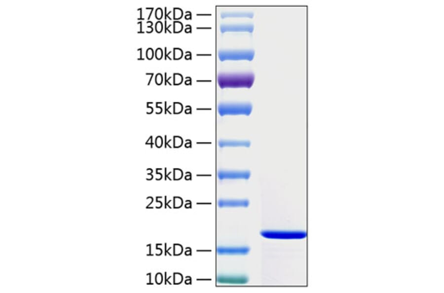 SDS-PAGE - Recombinant Human IFN gamma Protein (A330762) - Antibodies.com