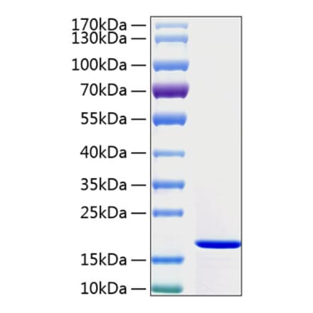 SDS-PAGE - Recombinant Human IFN gamma Protein (A330762) - Antibodies.com