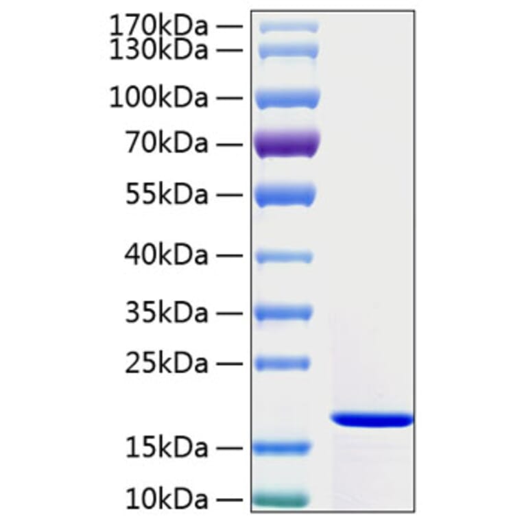 SDS-PAGE - Recombinant Human IFN gamma Protein (A330762) - Antibodies.com
