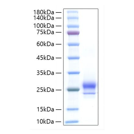 SDS-PAGE - Recombinant Human IFNA14 Protein (C-terminal His Tag) (A330764) - Antibodies.com